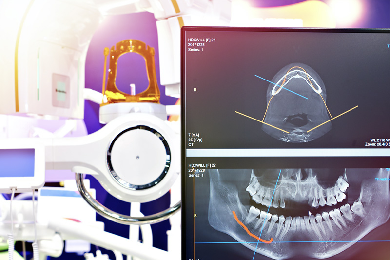 Digital X-Rays in Lancaster